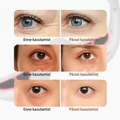 EyeGlow™ valgusteraapia silmahooldusprillid