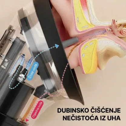 Električni set za čišćenje ušiju EarPure™
