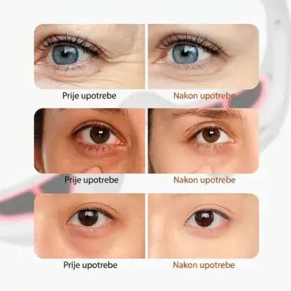 EyeGlow™ naočale za njegu očiju s terapijom svjetlom