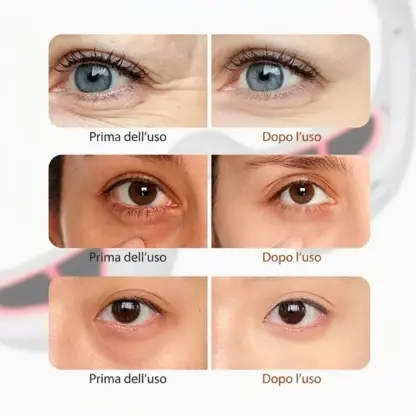 Occhiali EyeGlow™ per la cura degli occhi a terapia della luce